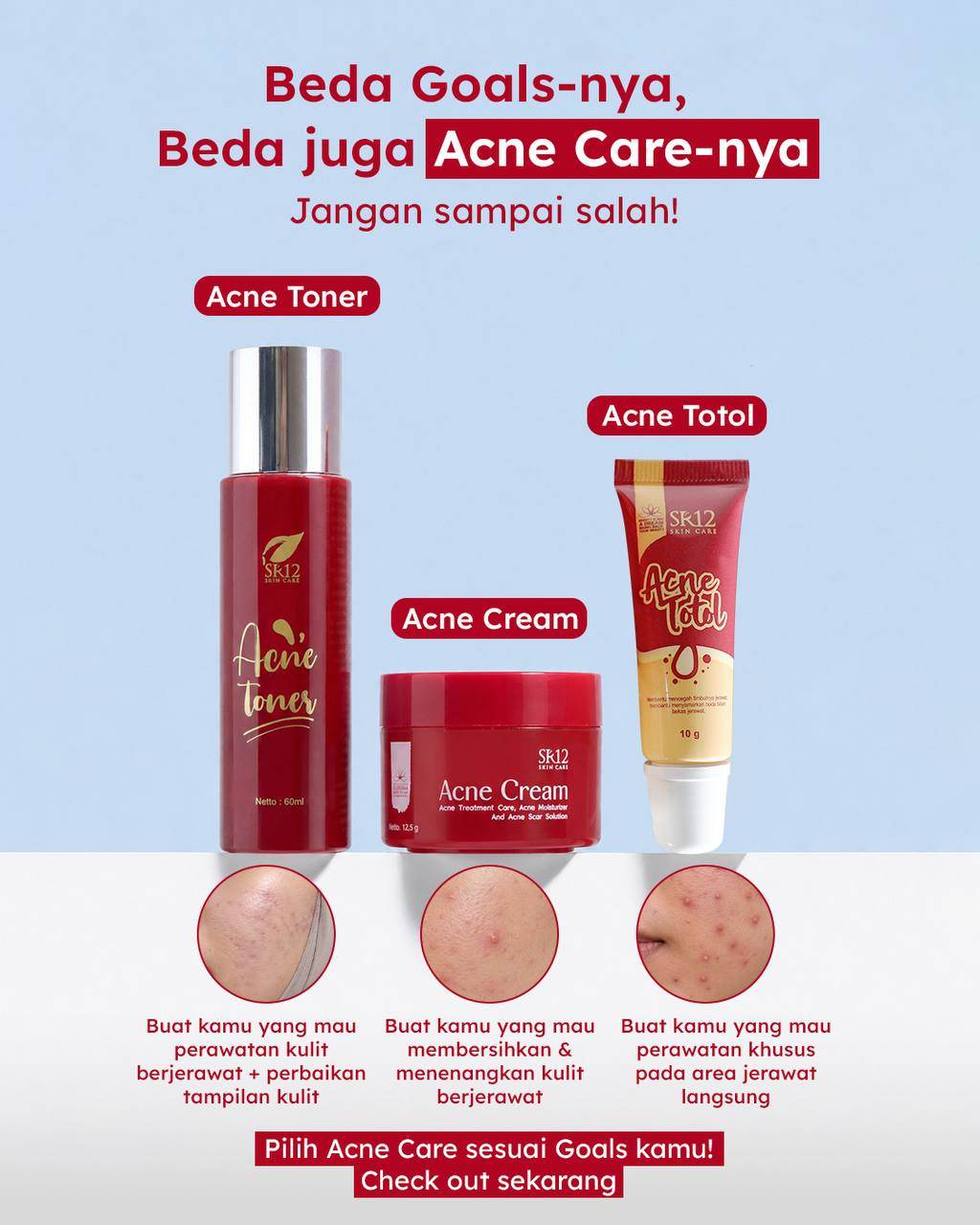 Acne Series_SR12 (Acne Cream / Acne Totol / Acne Toner / Toner BHA) Bebas Jerawat dalam 14 Hari Kempes Mencerahkan Antioksidan